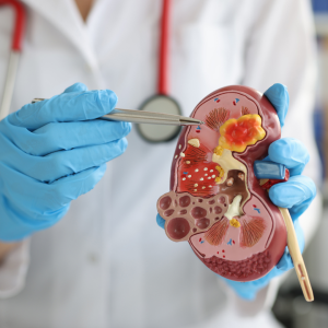 Chronic Health Issues